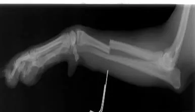Radiografía de fractura de radio y ulna en un perro