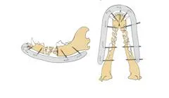 Esquema de mandíbula de perro con fijador esquelético externo