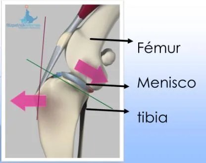 Esquema de rodilla con fémur, menisco y tibia