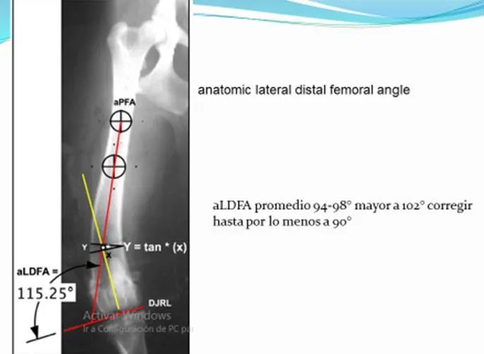 Radiografía de fémur con las líneas aPFA y DJRL trazadas para medir el ángulo aLDFA