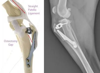 Esquema y radiografía de rodilla con implante de TTA