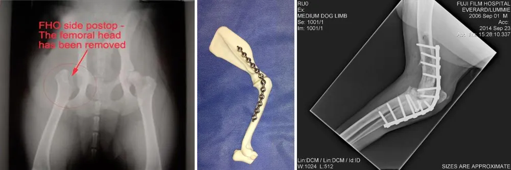 Radiografía de cadera tras retirar la cabeza del fémur, modelo de hueso con placa y radiografía de una artrodesis con placa